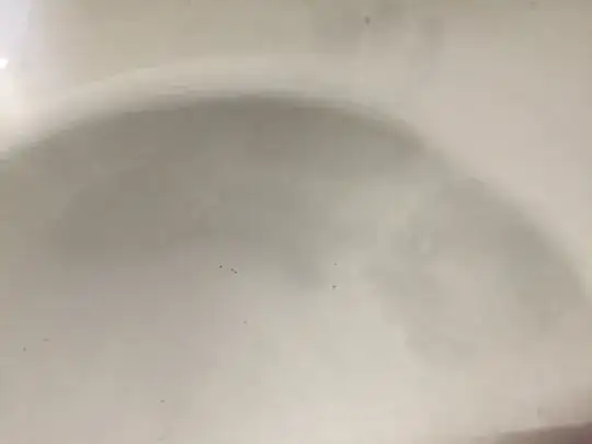 Discoloration 1