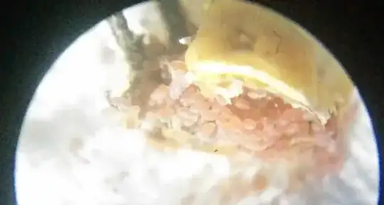 I had a small microscope handy