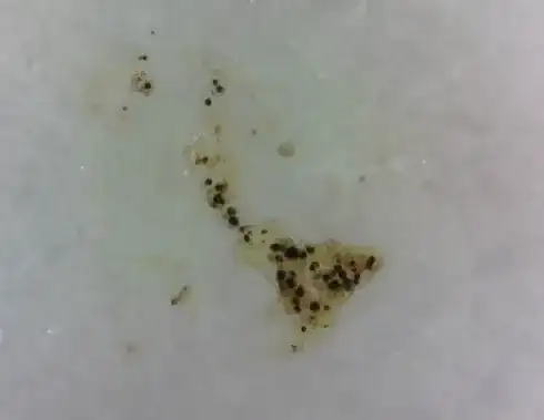 eggs