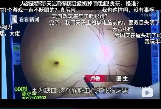 Still of woman's eye