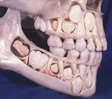 picture described as a child's skull on Pinterest, originally from the Tobokoz photoblog