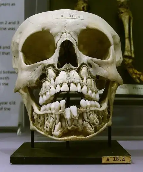 Children's skull
