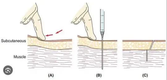 Z-track injection by pulling skin sideways, injecting, then releasing. From https://www.pharmapproach.com/intramuscular-route-of-drug-administration-advantages-and-disadvantages/