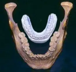 Jaw comparison: Human vs. "Giant"