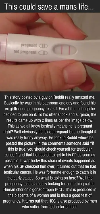 reddit story