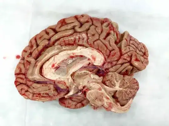 disection of fresh human brain