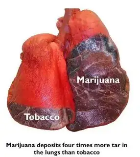 Picture of lungs