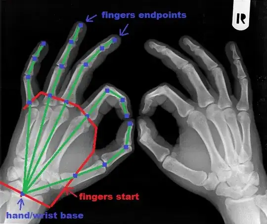 xray/kinematics